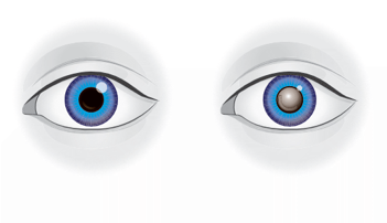 Eye Illustration